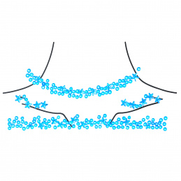 Aga4Kids Self-Adhesive Stones DS8114MB